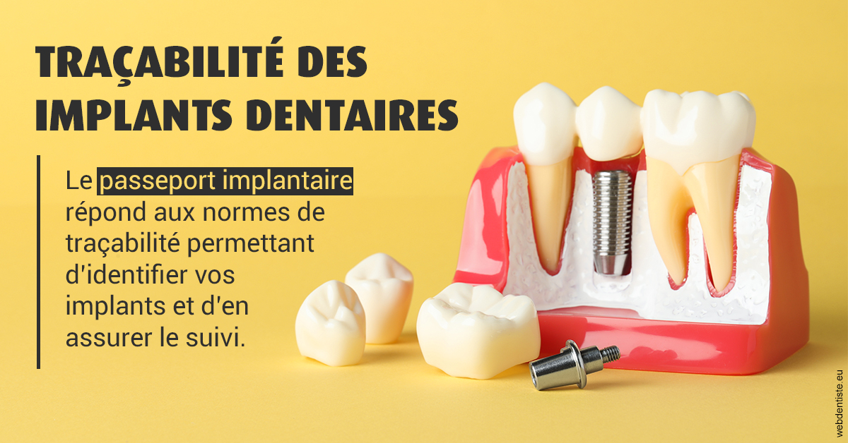 https://www.chirurgien-dentiste-cannes.com/T2 2023 - Traçabilité des implants 2