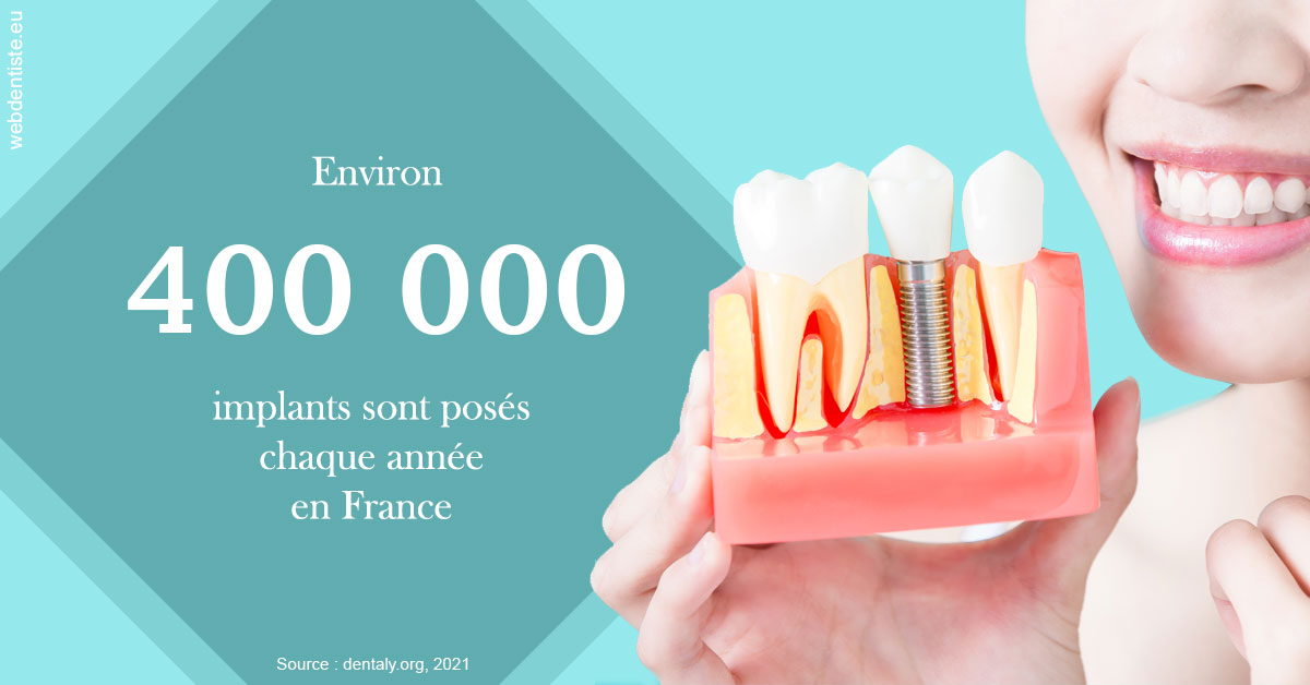 https://www.chirurgien-dentiste-cannes.com/Pose d'implants en France 2