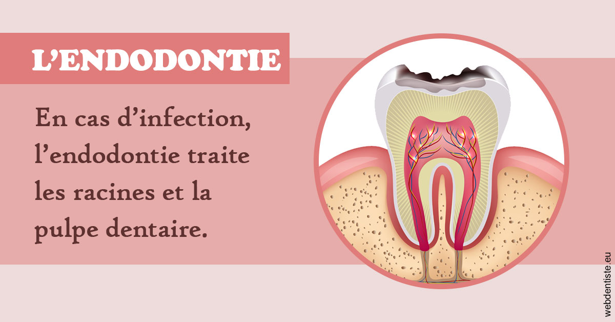 https://www.chirurgien-dentiste-cannes.com/L'endodontie 2
