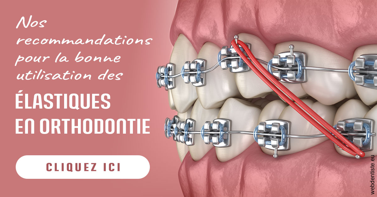https://www.chirurgien-dentiste-cannes.com/Elastiques orthodontie 2